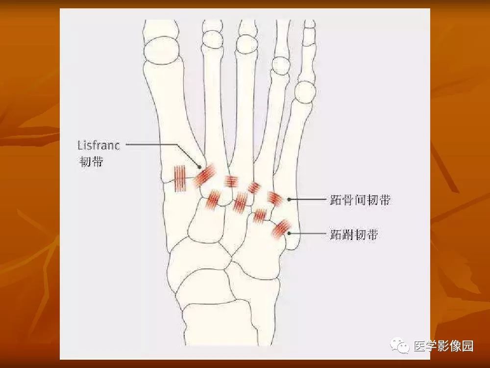 【PPT】踝关节韧带的解剖及影像表现