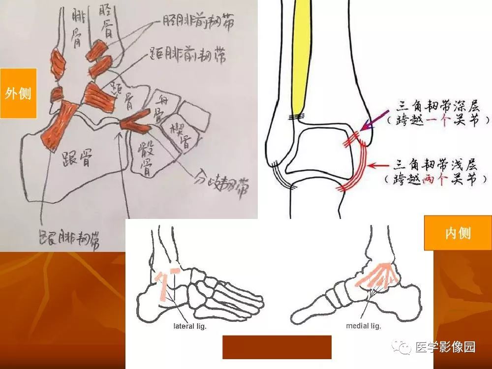 【PPT】踝关节韧带的解剖及影像表现