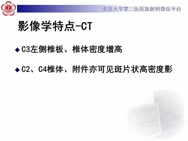 【病例】颈椎骨母细胞瘤1例CT影像表现