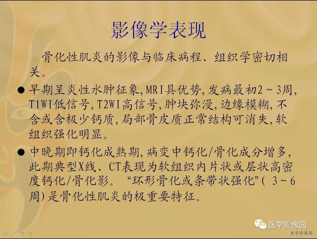 【病例】骨化性肌炎1例X线CT及MR影像表现