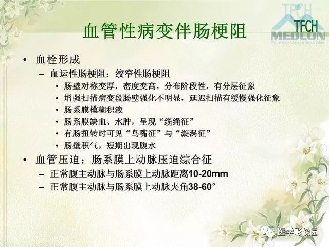 【PPT】肠梗阻MSCT病因诊断