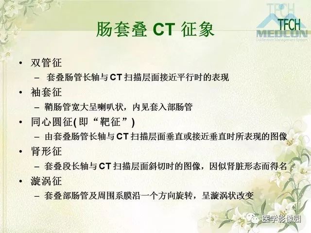 【PPT】肠梗阻MSCT病因诊断