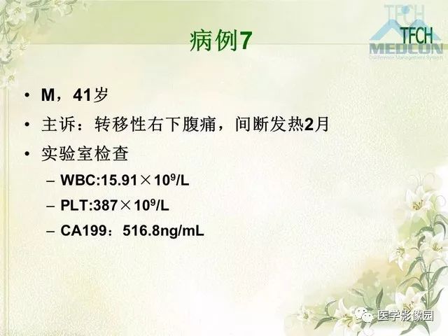 【PPT】肠梗阻MSCT病因诊断