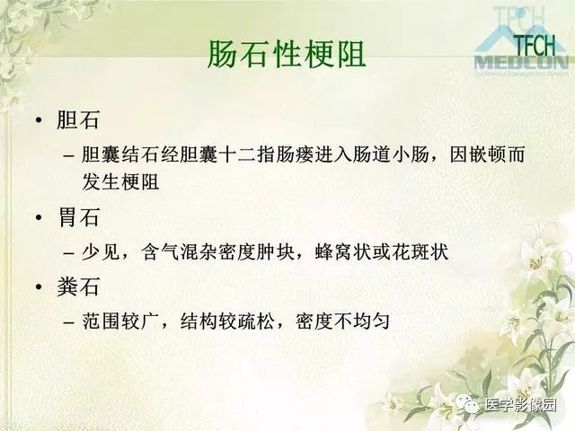 【PPT】肠梗阻MSCT病因诊断