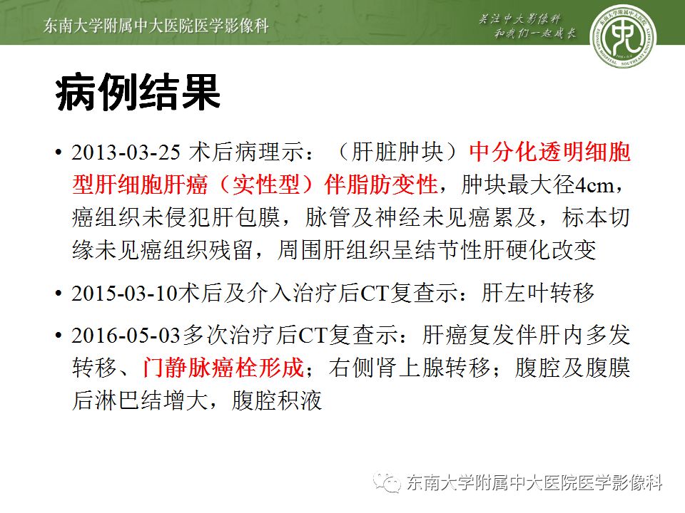 【病例】透明细胞型肝细胞肝癌伴脂肪变性及门静脉癌栓1例CT