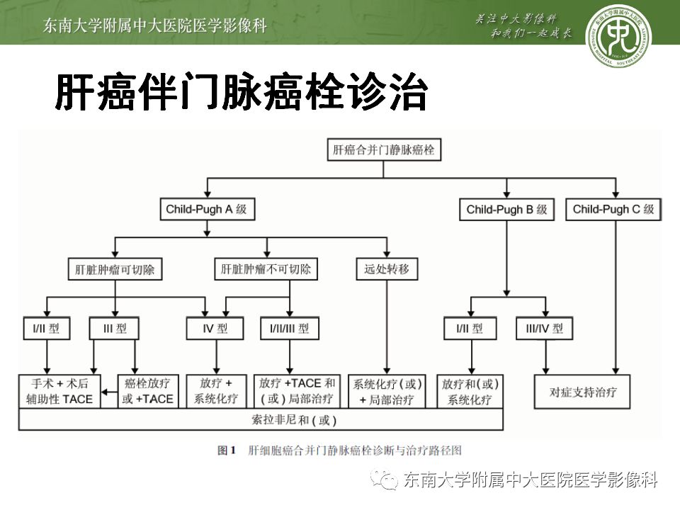 【病例】透明细胞型肝细胞肝癌伴脂肪变性及门静脉癌栓1例CT