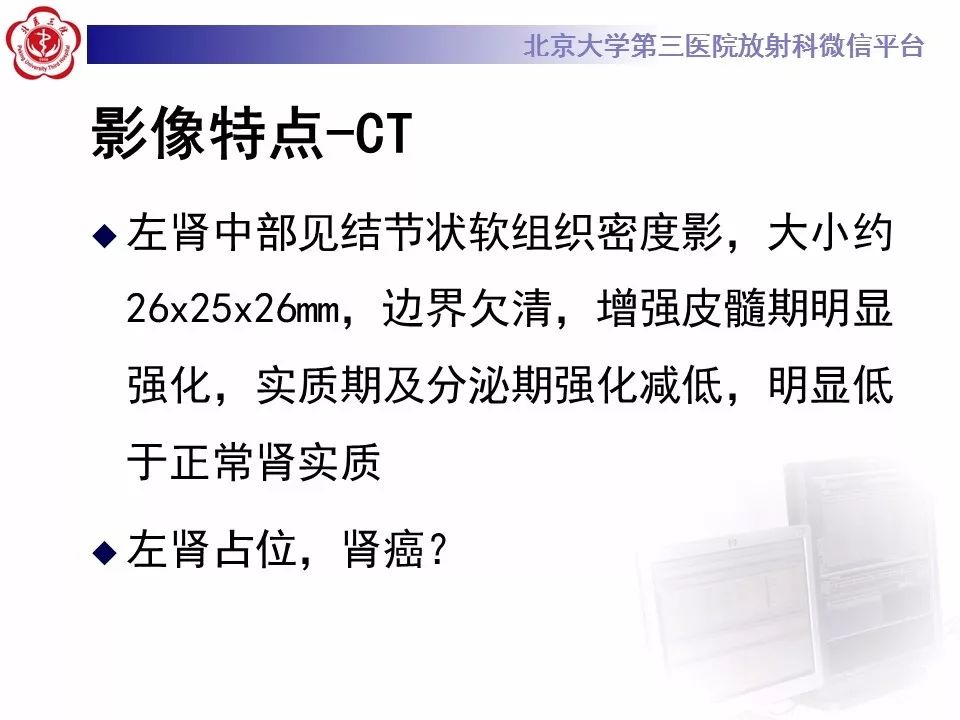 【病例】肾嗜酸细胞腺瘤1例CT影像诊断