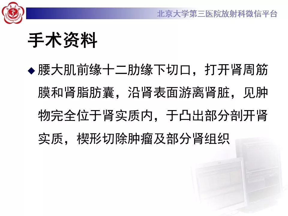 【病例】肾嗜酸细胞腺瘤1例CT影像诊断
