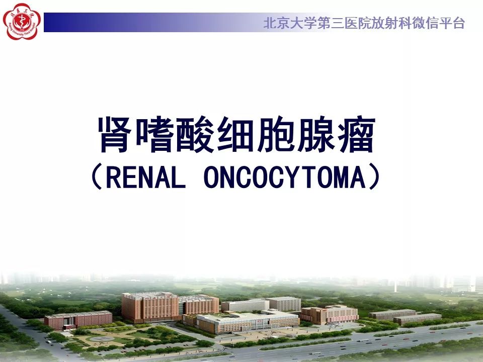 【病例】肾嗜酸细胞腺瘤1例CT影像诊断