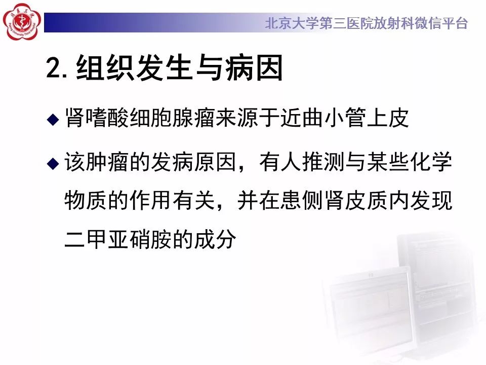 【病例】肾嗜酸细胞腺瘤1例CT影像诊断