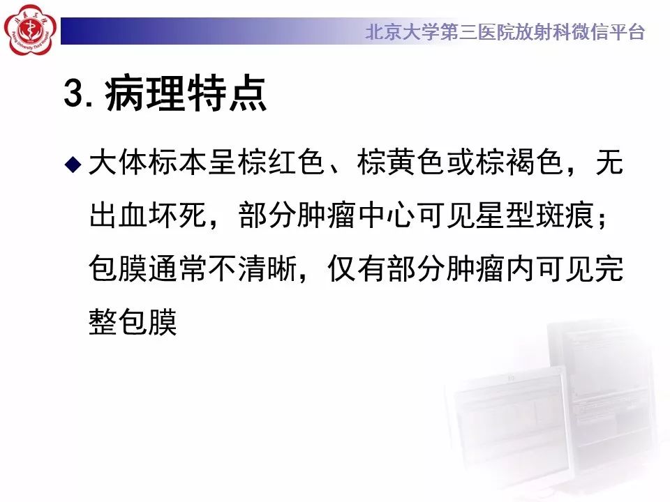 【病例】肾嗜酸细胞腺瘤1例CT影像诊断