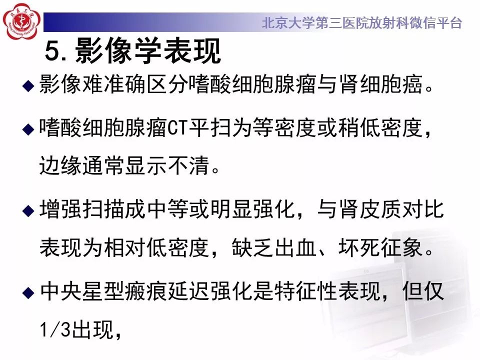 【病例】肾嗜酸细胞腺瘤1例CT影像诊断