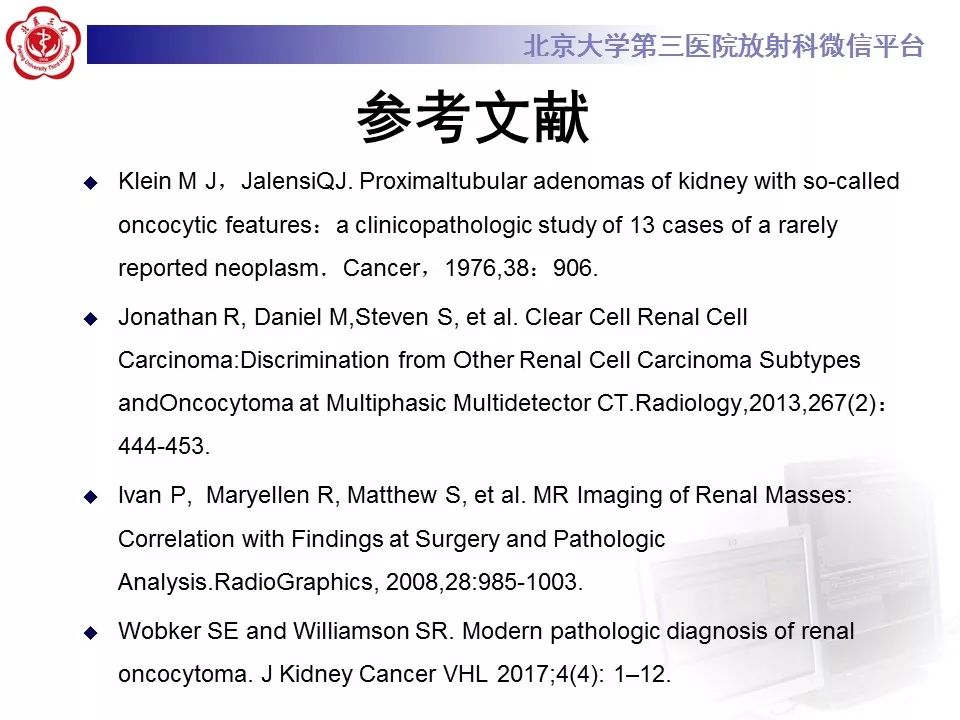 【病例】肾嗜酸细胞腺瘤1例CT影像诊断