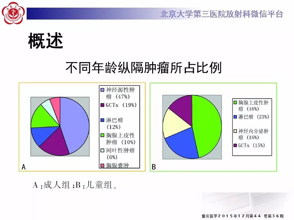 【病例】胸腺神经内分泌肿瘤1例CT影像表现