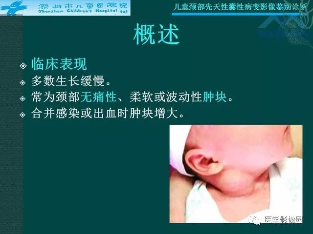 【PPT】儿童颈部先天性囊性病变影像鉴别诊断