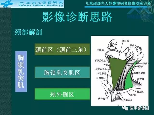 【PPT】儿童颈部先天性囊性病变影像鉴别诊断