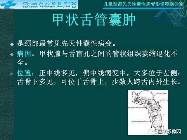 【PPT】儿童颈部先天性囊性病变影像鉴别诊断