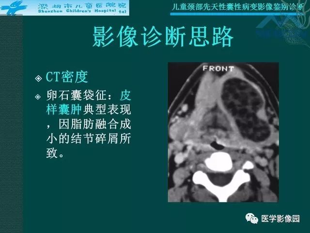 【PPT】儿童颈部先天性囊性病变影像鉴别诊断