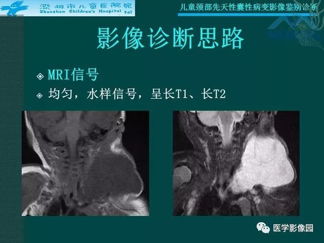 【PPT】儿童颈部先天性囊性病变影像鉴别诊断