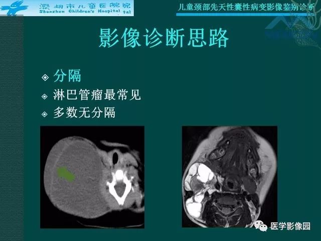 【PPT】儿童颈部先天性囊性病变影像鉴别诊断