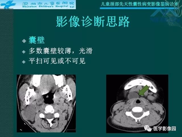 【PPT】儿童颈部先天性囊性病变影像鉴别诊断