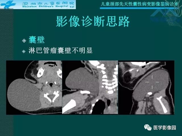 【PPT】儿童颈部先天性囊性病变影像鉴别诊断