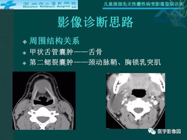 【PPT】儿童颈部先天性囊性病变影像鉴别诊断