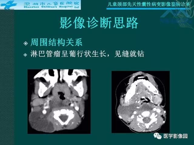 【PPT】儿童颈部先天性囊性病变影像鉴别诊断