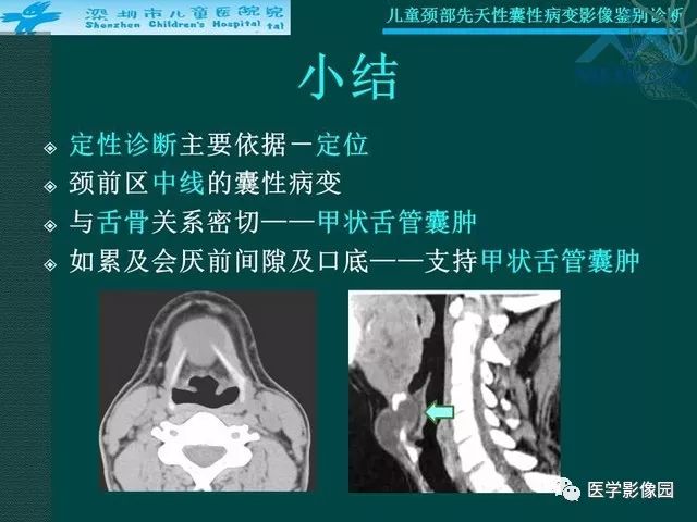 【PPT】儿童颈部先天性囊性病变影像鉴别诊断