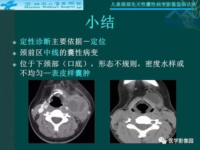 【PPT】儿童颈部先天性囊性病变影像鉴别诊断