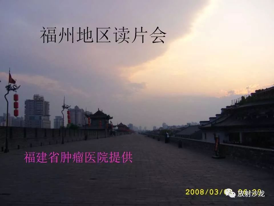 【病例】肝脏蔓状血管瘤1例CT影像表现