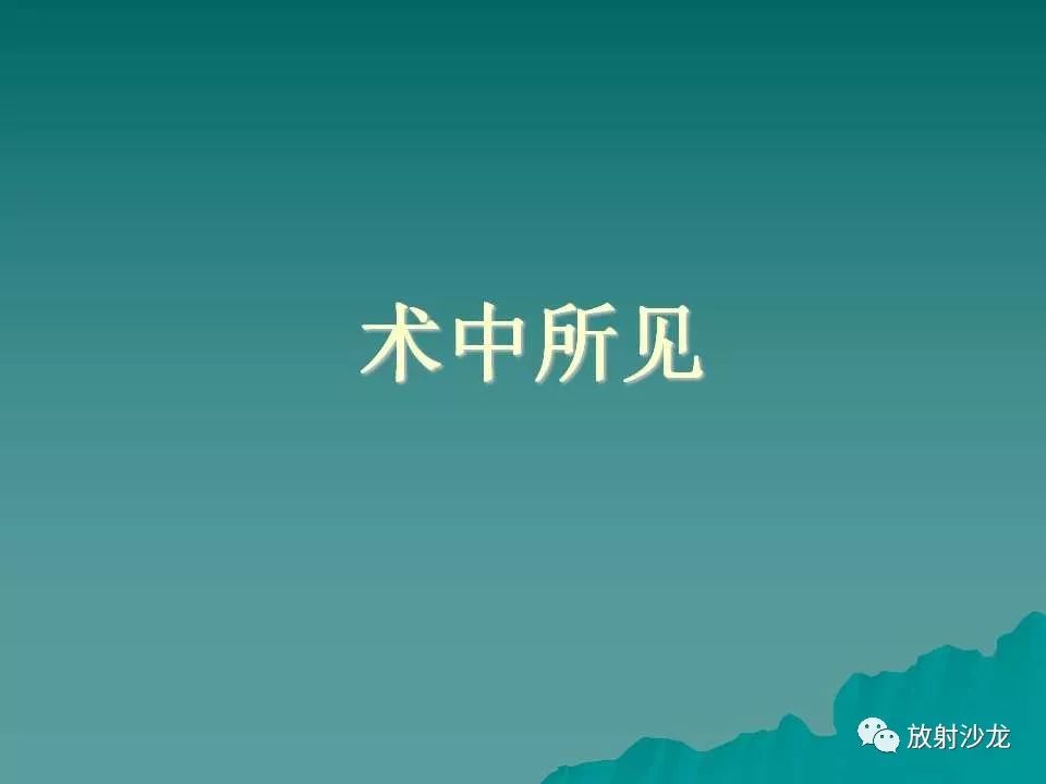 【病例】肝脏蔓状血管瘤1例CT影像表现