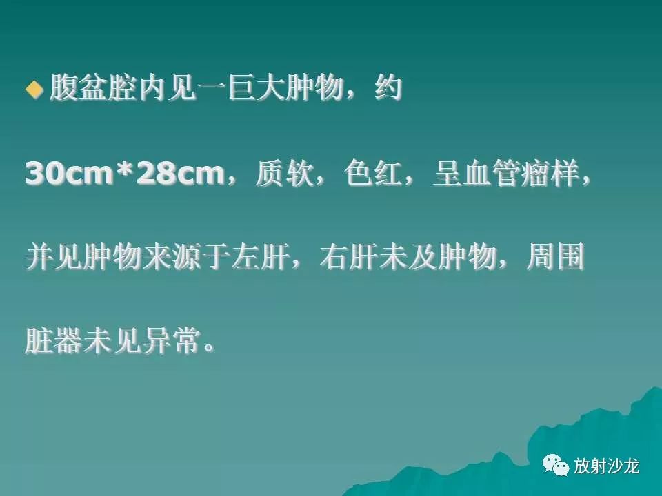【病例】肝脏蔓状血管瘤1例CT影像表现
