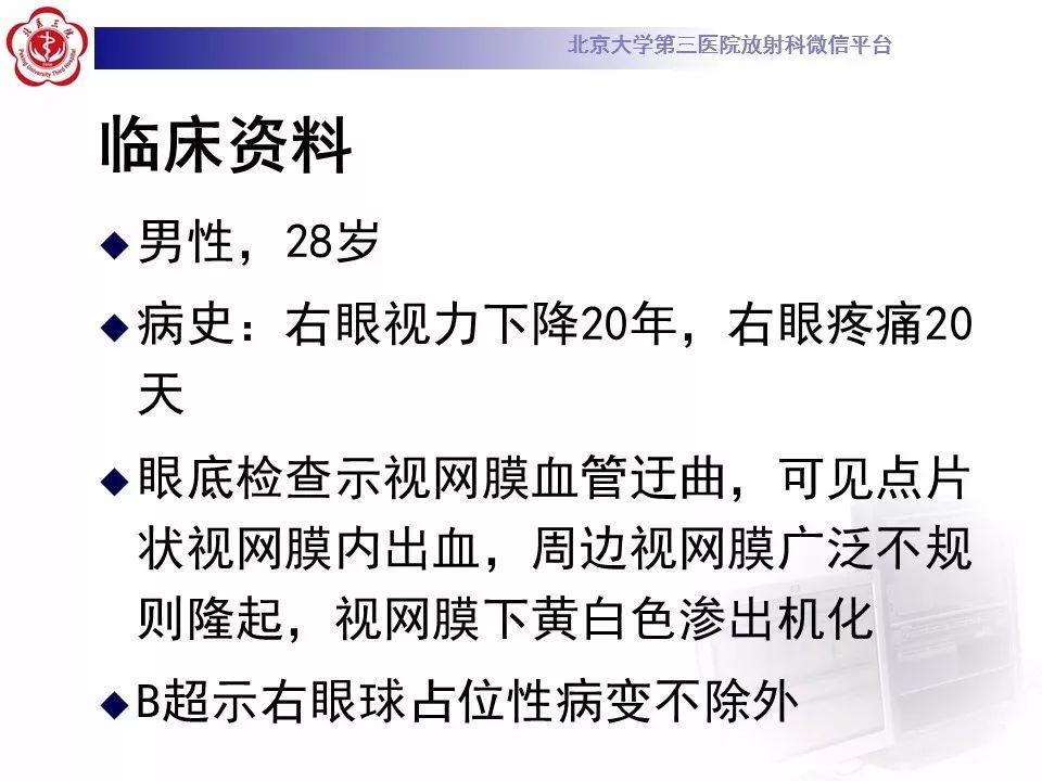 【病例】右眼Coats病1例CT及MR影像诊断