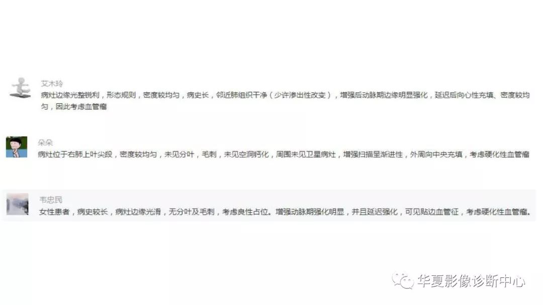 【病例】肺硬化性血管瘤1例CT影像表现