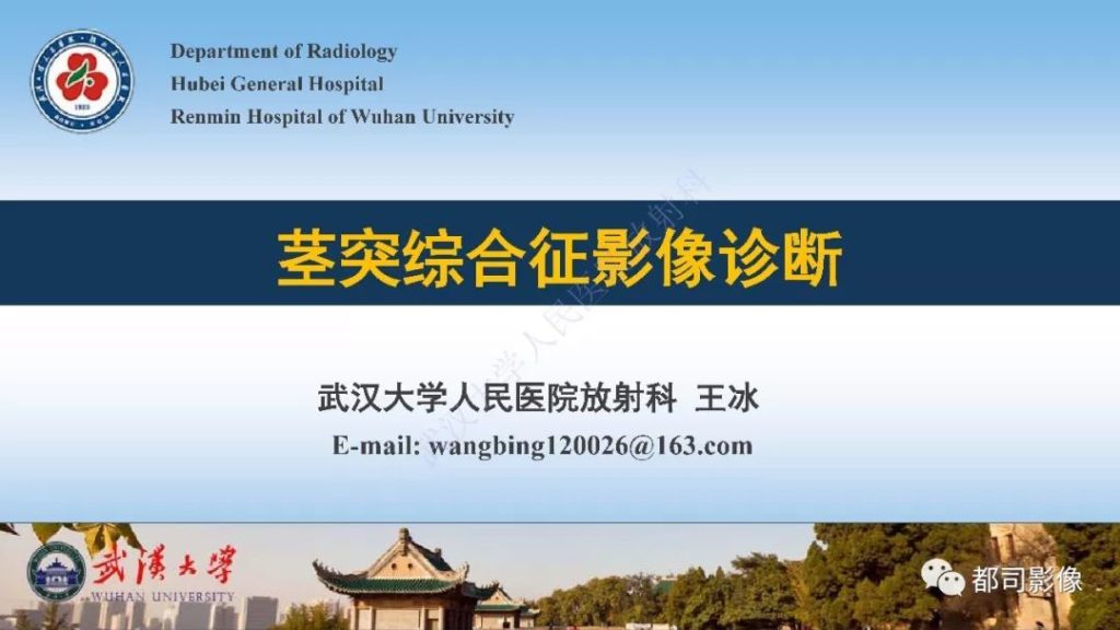 【PPT】茎突综合征影像诊断