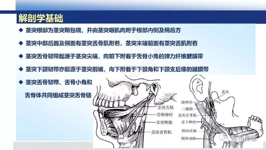 【PPT】茎突综合征影像诊断