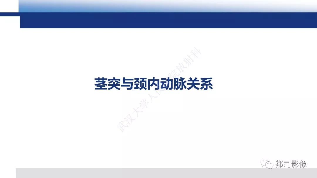 【PPT】茎突综合征影像诊断