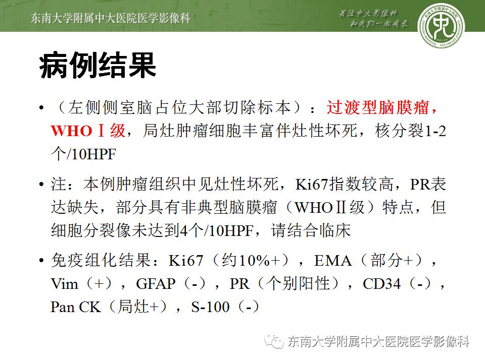 【病例】脑室内脑膜瘤1例CT及MR影像诊断