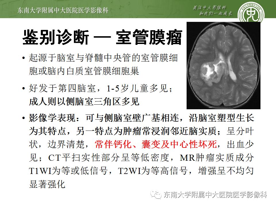【病例】脑室内脑膜瘤1例CT及MR影像诊断