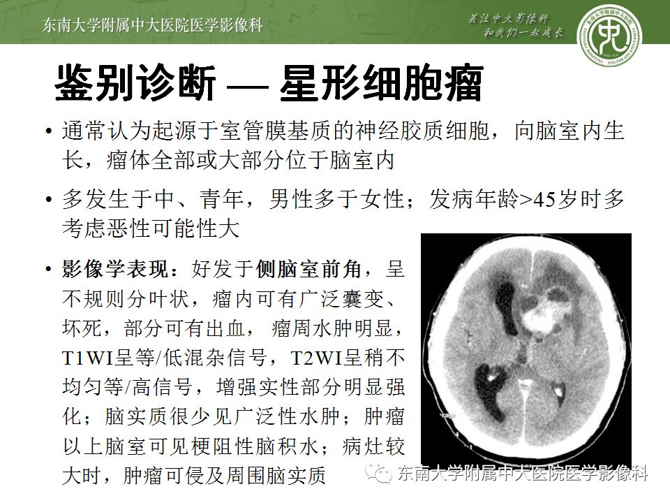 【病例】脑室内脑膜瘤1例CT及MR影像诊断