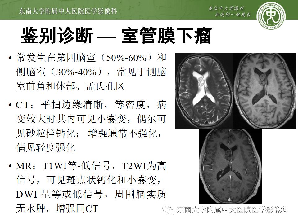 【病例】脑室内脑膜瘤1例CT及MR影像诊断