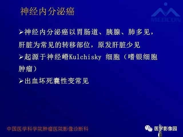 【PPT】肝脏富血供肿瘤CT、MRI诊断
