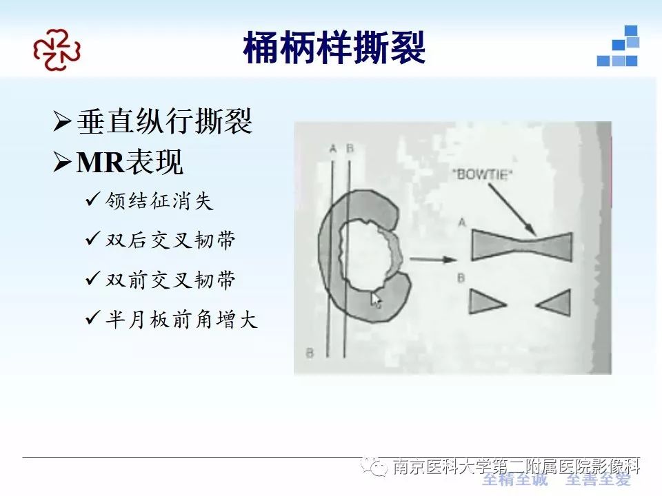 【PPT】膝关节运动损伤的MR表现