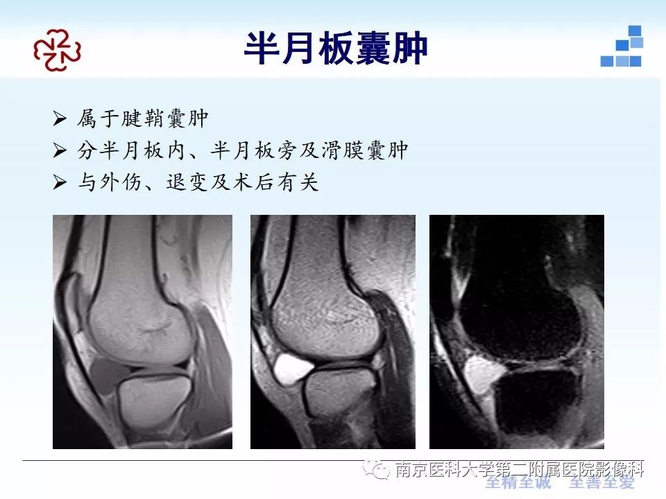 【PPT】膝关节运动损伤的MR表现