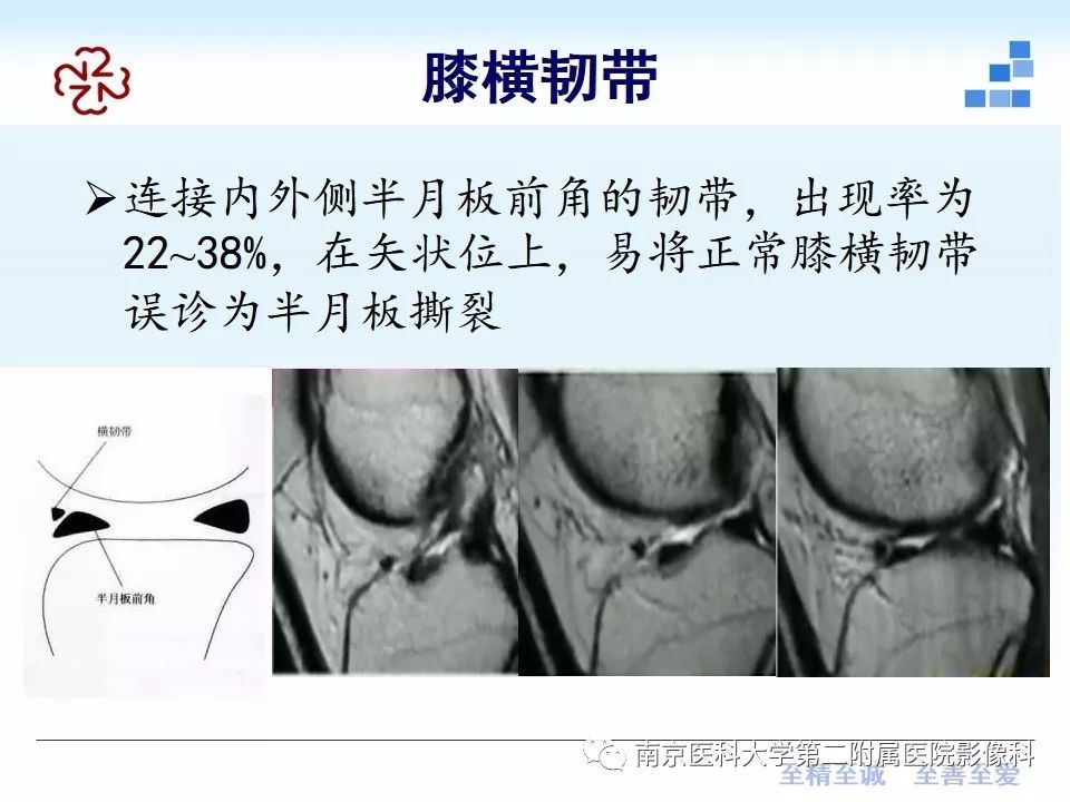 【PPT】膝关节运动损伤的MR表现