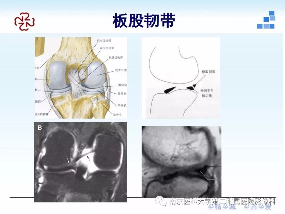 【PPT】膝关节运动损伤的MR表现