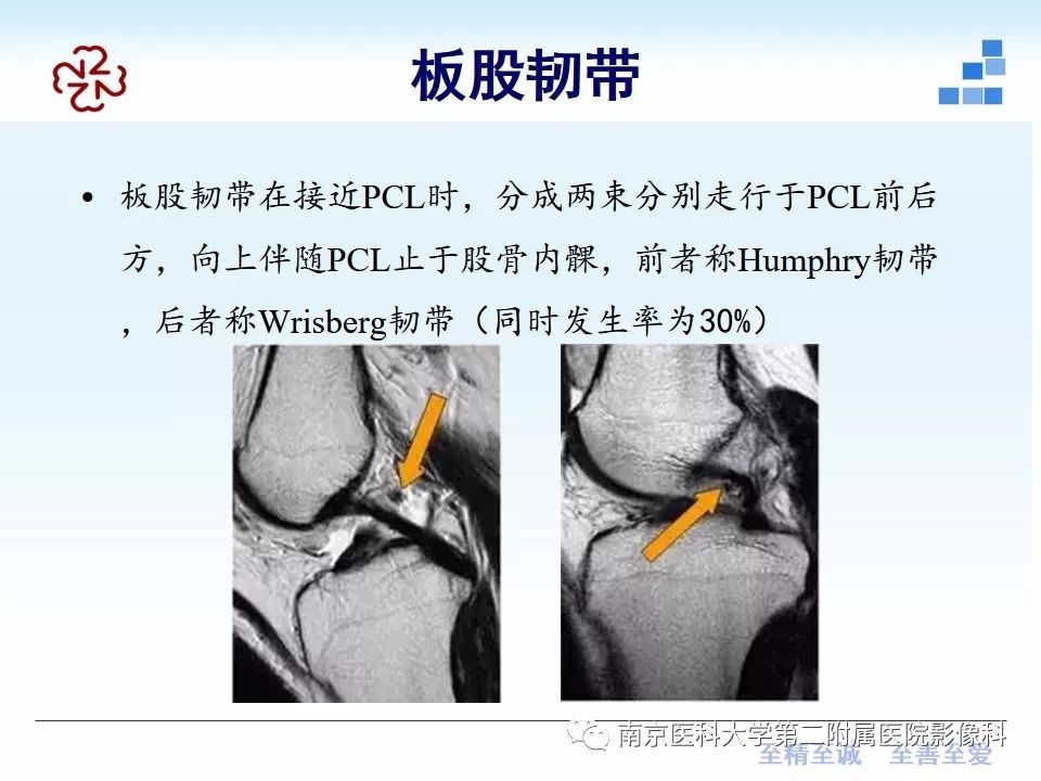 【PPT】膝关节运动损伤的MR表现