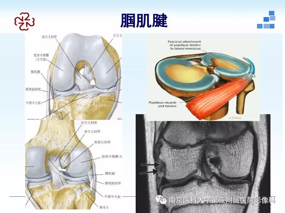 【PPT】膝关节运动损伤的MR表现