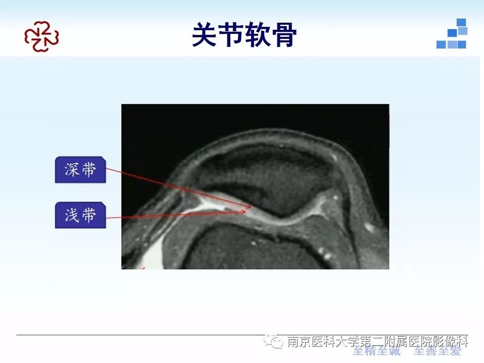【PPT】膝关节运动损伤的MR表现